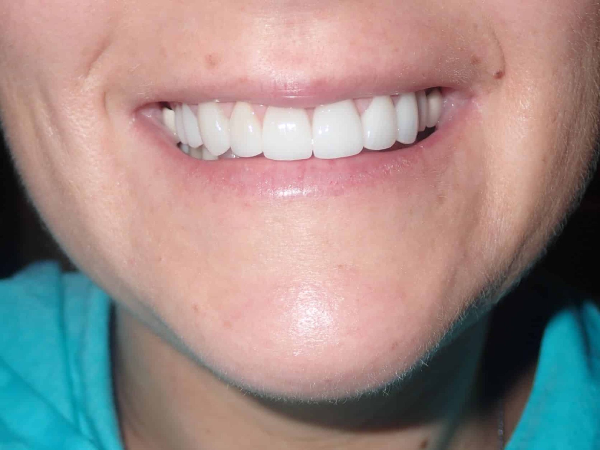 Smile Gallery — Anderson Dental